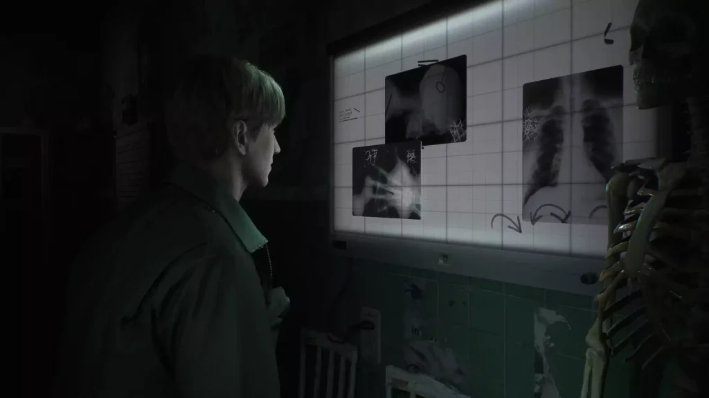 Silent Hill 2 Remake Screenshot 3